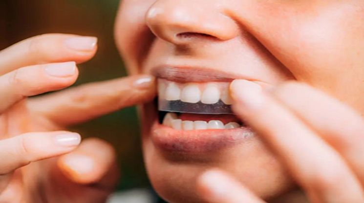 Posso comer depois de usar as tiras de clareamento dental Onuge?