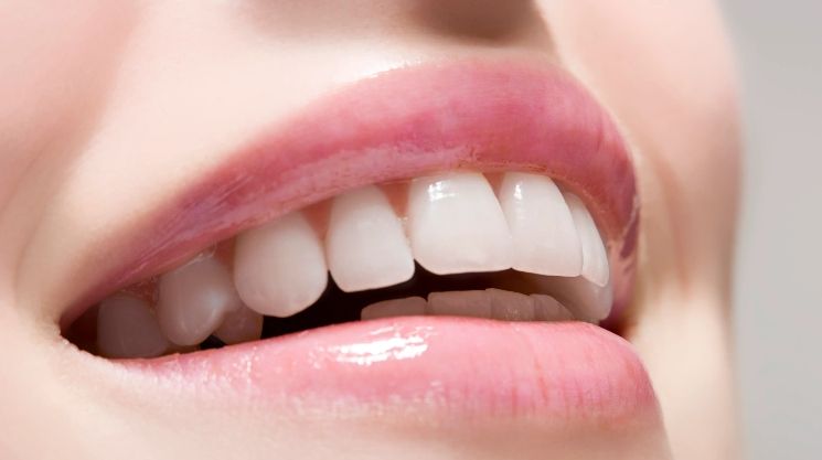 Como usar o gel clareador dental com segurança em casa? Guia completo